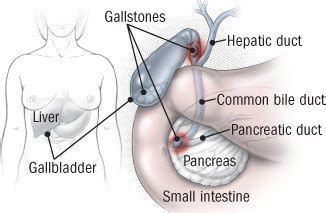 Bile Duct Diseases Guide: Causes, Symptoms and Treatment Options