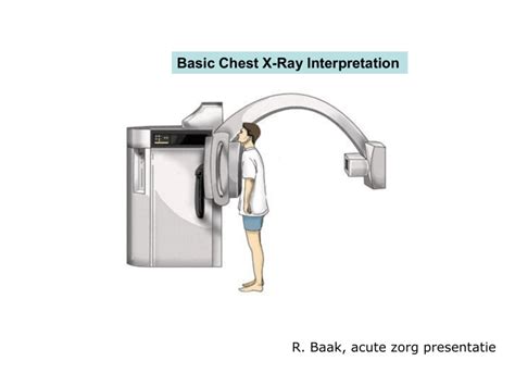 Basic Chest X-Ray Interpretation - HagaZiekenhuis ( PDFDrive )