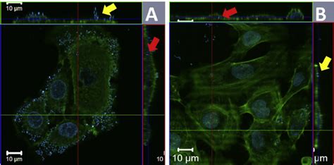 Infection of human keratinocytes by bovine Streptococcus dysgalactiae... | Download Scientific ...