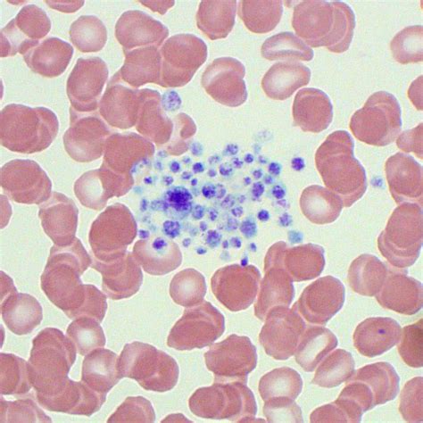 Platelet Morphology | Blood Film - MedSchool