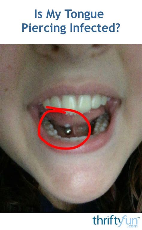 Is My Tongue Piercing Infected? | ThriftyFun