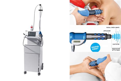 Shockwave Therapy Birmingham | ESWT Wolverhampton