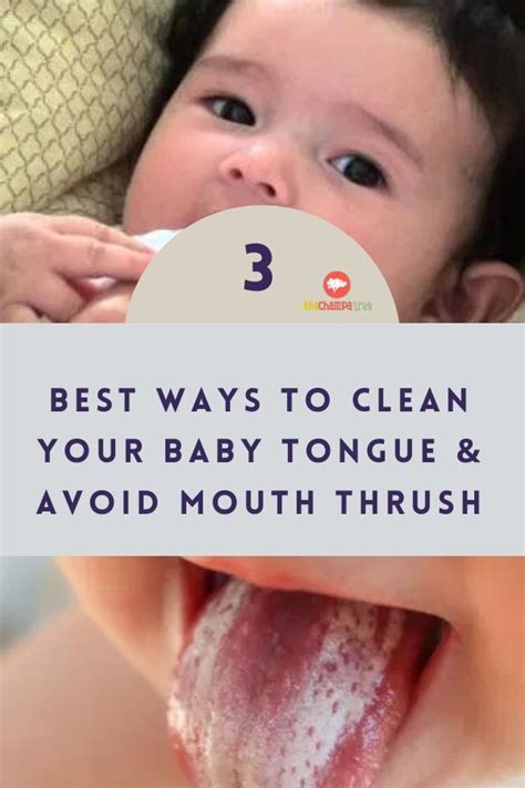 Clean Your baby Tongue: 3 Best Ways To Avoid Mouth Thrush | Baby tongue ...