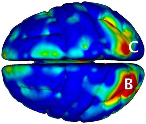 Map of anatomical correlations. The tip of the superior temporal sulcus... | Download Scientific ...