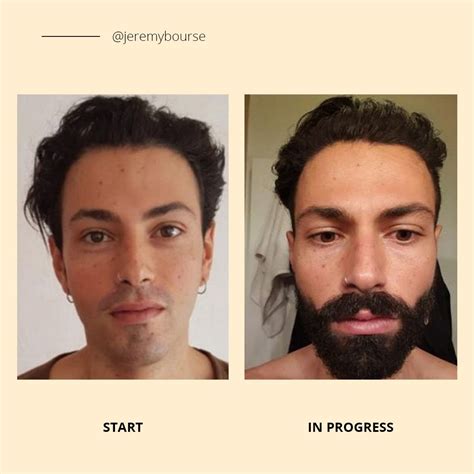 before and after derma roller beard - cortezleong