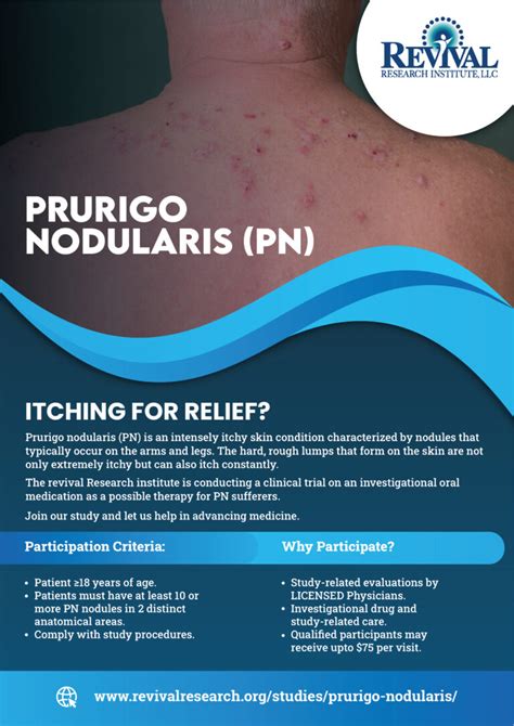 Prurigo Nodularis Clinical Trials