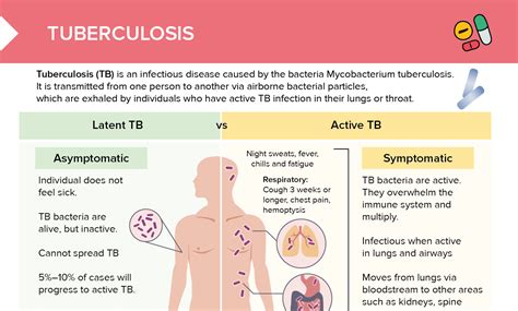 Tuberculosis [+ Free Cheat Sheet] | Lecturio