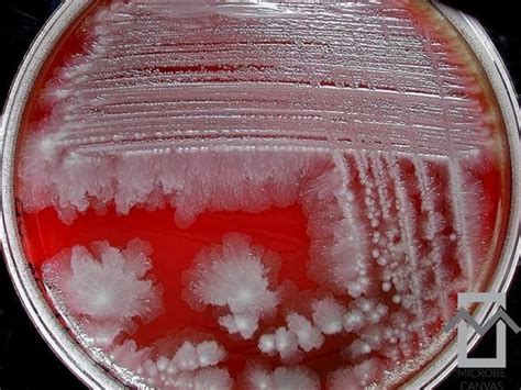 Biochemical Test of Hafnia alvei