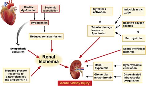 Cardiorenal Syndrome: An Overview - Advances in Chronic Kidney Disease