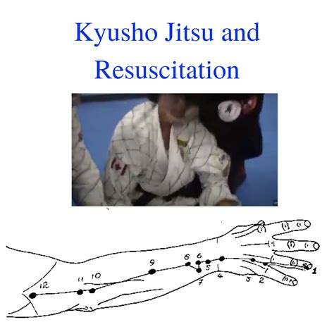 Kyusho Jitsu And Resuscitation. Protect Your Uke