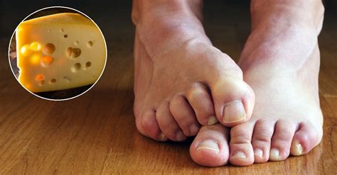 This Is The Actual Scientific Reason That Feet Smell Like Cheese