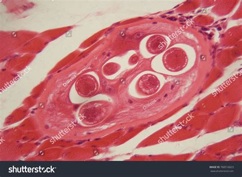 Trichinella Spiralis Larvae Muscle Tissue Under Stock Photo 768516823 ...