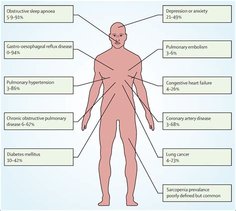 Idiopathic pulmonary fibrosis: effects and optimal management of ...