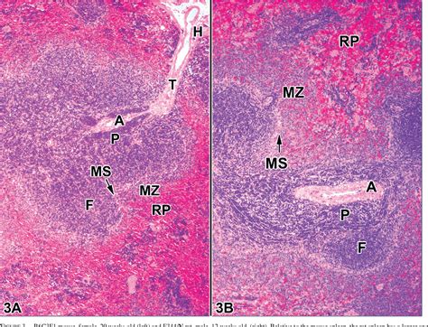 Normal Structure, Function, and Histology of the Spleen | Semantic Scholar