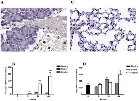 Changes in pancreatic and lung F4/80 + macrophage number during acute... | Download Scientific ...