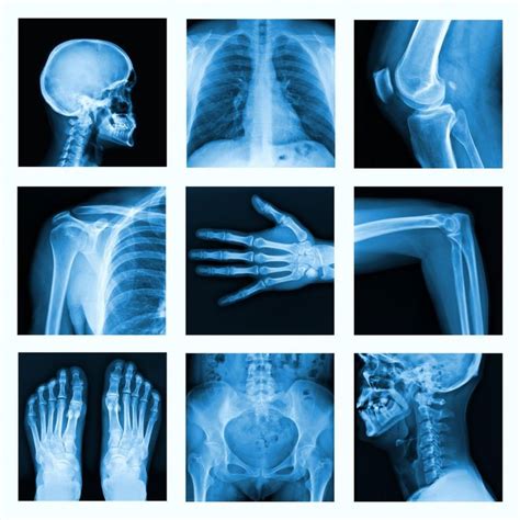 Pinterest | Radiology, X ray, Bone injuries