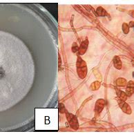 Alternaria alternata:-(A) symptoms of the pathogen on the leaf of... | Download Scientific Diagram