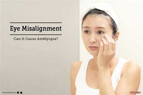 Eye Misalignment - Can It Cause Amblyopia? - By Asg Eye Hospital | Lybrate