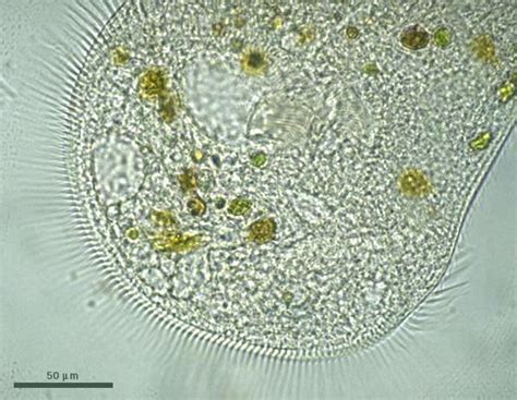 Ciliophora roeseli - a Protist. Notice the little hairs=cilia