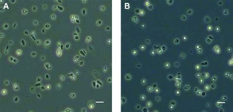 Figure S3: Spheroplast formation of yeast cells from 0 and 14 day old... | Download Scientific ...