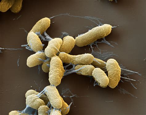 Plague Bacteria Yersinia Pestis, Sem Photograph by Meckes/ottawa - Fine ...