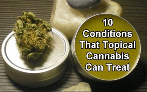 10 Conditions That Topical Cannabis Can Treat