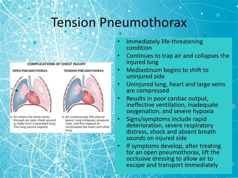 PPT - Chest Trauma PowerPoint Presentation - ID:5319182