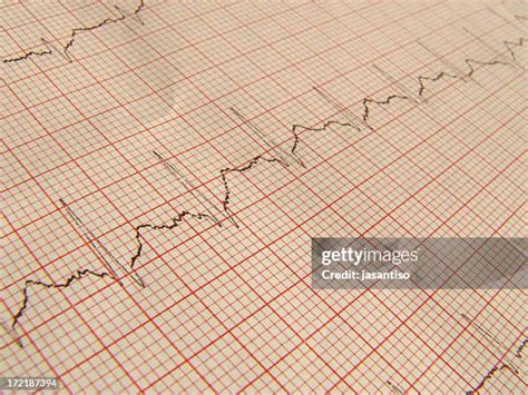 630 Ecg Paper Stock Photos, High-Res Pictures, and Images - Getty Images