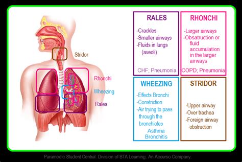 Paramedic Student Central: Lung Sounds Reference Chart