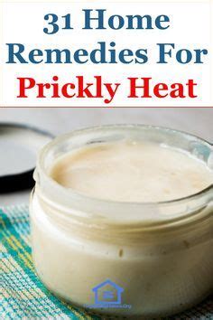 31 Effective Home Remedies For Prickly Heat (Heat Rash) | Heat rash, Home remedies for rashes ...