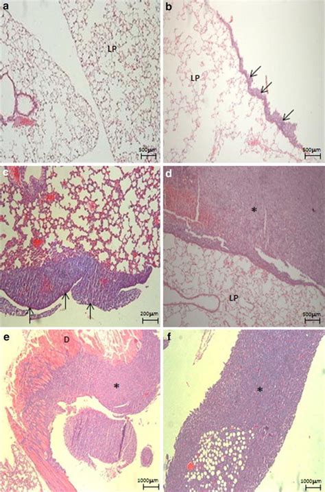 Histology of pleura, lung parenchyma and diaphragm of mice that... | Download Scientific Diagram