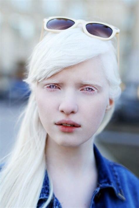 Nastya Zhidkova albino model with sunglasses | Albino girl, Albino ...