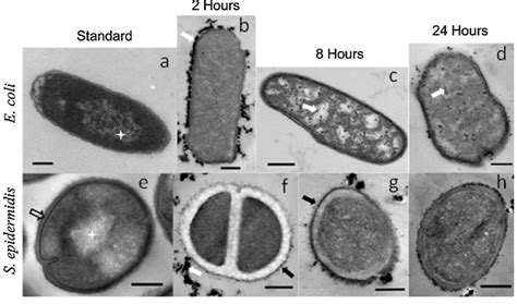 TEM images of gram-negative E. coli and gram-positive S. epidermidis... | Download Scientific ...