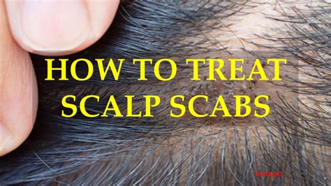 Why Do I Have Bumps And Scabs On My Scalp - Printable Templates Free