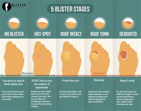 Foot care & blister treatment when hiking