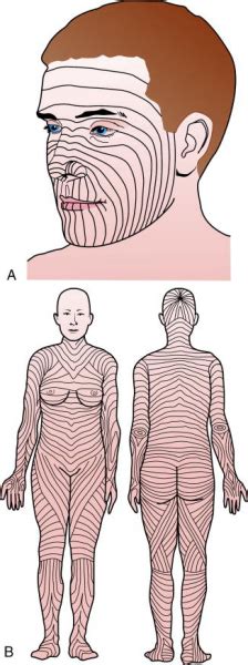 Doctors Gates: Skin Tension Lines and how to get it