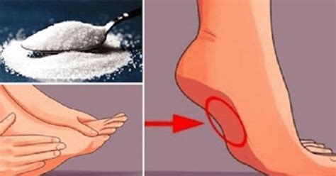 These 7 symptoms might be telling you that you’re eating too much salt