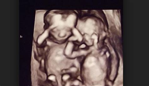 Video of Twin Unborn Babies Provides Breathtaking Glimpse Inside the Womb - LifeNews.com