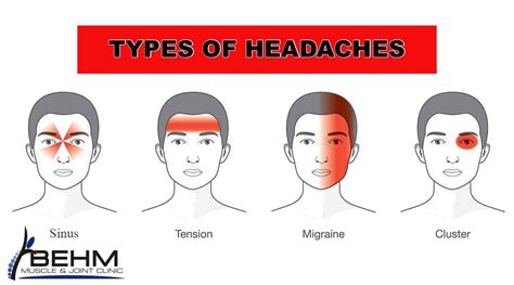 Headache Treatment