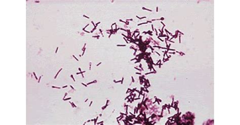 Clostridium tetani : Diagnosis, treatment and Prevention - New