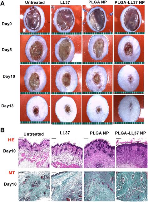 Granulation Tissue Wound Healing Pictures - focistalany