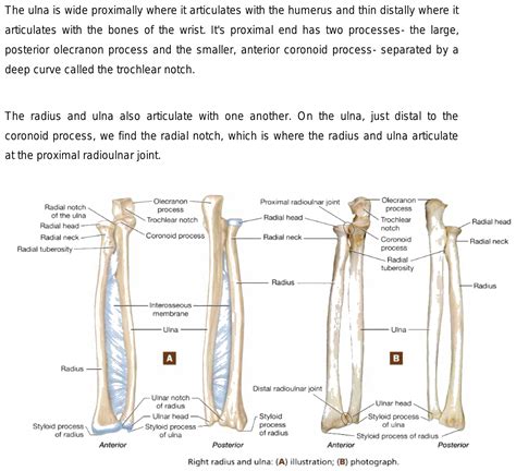 What is the difference between sigmoid notch and radial notch?