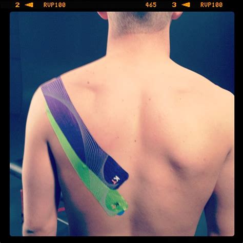 KT Tape:shoulder Stability | Flickr - Photo Sharing!