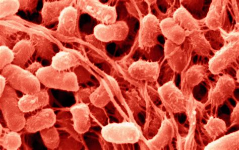 Serratia marcescens bacteria, sources of infection, risk factors & treatment