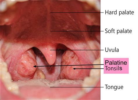 Throat Cancer - Causes, Signs, Symptoms, Survival Rate & Treatment