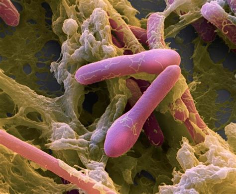 Clostridium botulinum bacteria. | Download Scientific Diagram