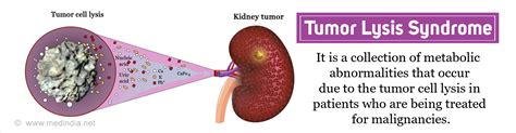 Tumor Lysis Rash