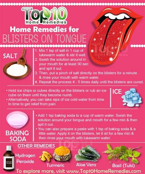 Home Remedies for Blisters on Tongue | Top 10 Home Remedies