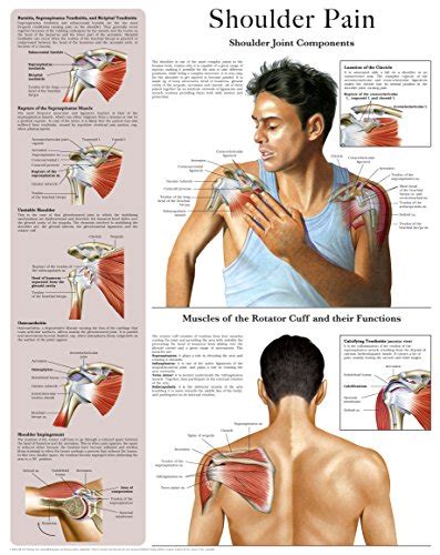 Shoulder Injury Diagram