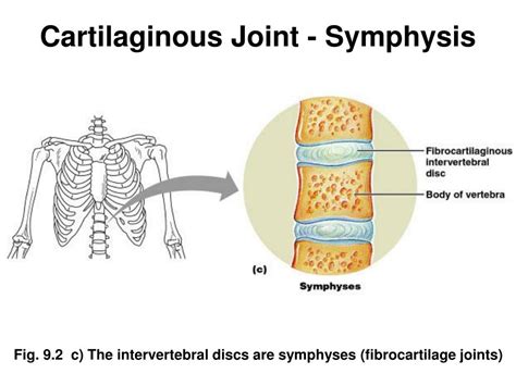 PPT - Joints Bone Connections PowerPoint Presentation, free download - ID:176707